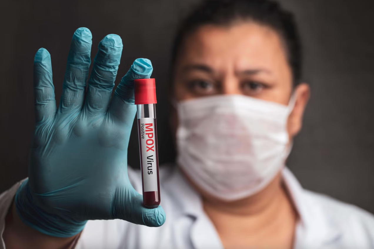 Royaume-Uni: premières transmissions locales du nouveau variant du mpox hors d'Afrique (OMS)